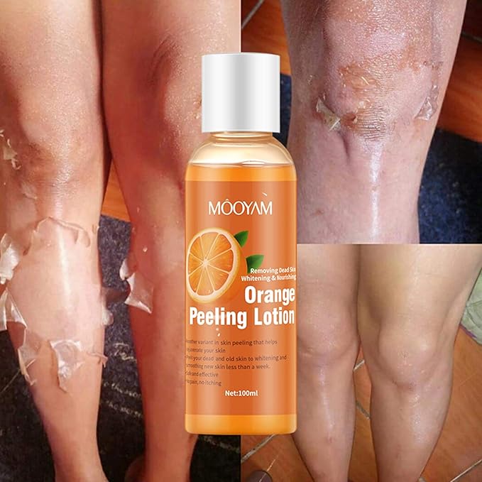 Mooyam Orange Peeling Lotion 100ml - Whitening & Exfoliating Body Lotion
